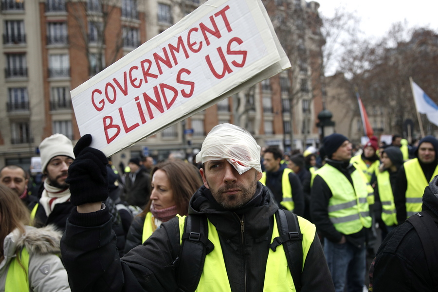 epa07337897 A Protester from the 'Gilets Jaunes' (Yellow Vests) movement wears a bandage on the eye to denounce the use of LBD 40 (defense gun)  by French police forces as he holds a poster reading ' Government Blind Us'  during the 'Act XII' demonstration (the 12th consecutive national protest on a Saturday) in Paris, France, 02 February 2019. The so-called 'gilets jaunes' (yellow vests) is a grassroots protest movement with supporters from a wide span of the political spectrum, that originally started with protest across the nation in late 2018 against high fuel prices. The movement in the meantime also protests the French government's tax reforms, the increasing costs of living and some even call for the resignation of French President Emmanuel Macron.  EPA/YOAN VALAT