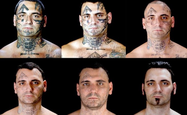 Μετανιωμένος ρατσιστής αφαιρεί όλα τα ναζιστικά τατουάζ