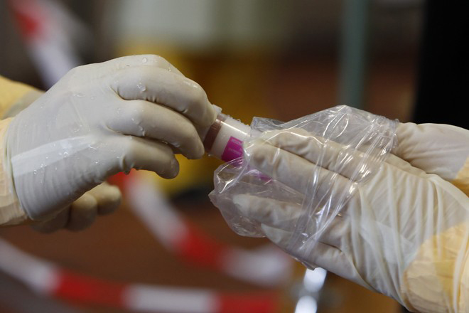 ΠΟΥ: Σύντομα τα νέα πειραματικά εμβόλια για τον Έμπολα