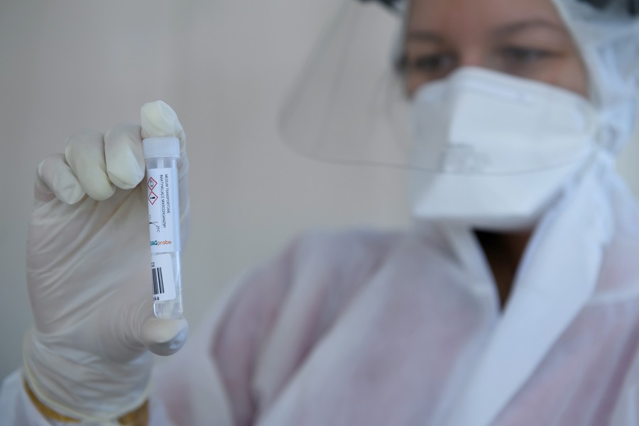 Η AstraZeneca στοχεύει σε 30 εκατομμύρια δόσεις εμβολίου κατά του κορωνοϊού έως τον Σεπτέμβριο