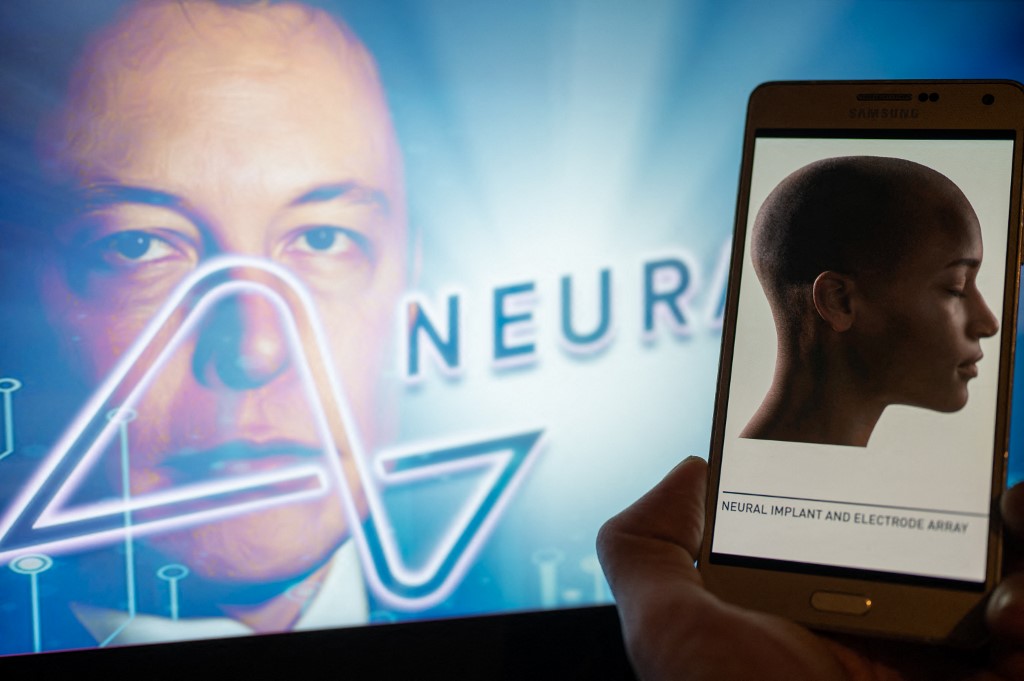 Neuralink: Ο πρώτος ασθενής με τσιπ στο εγκέφαλο ελέγχει ποντίκι υπολογιστή με τη σκέψη του